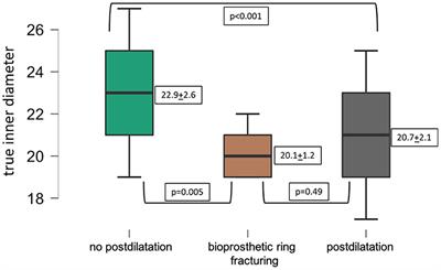 Frequency of Bioprosthetic Valve Fracturing Utilization in an All-Comers Valve-in-Valve TAVR Cohort